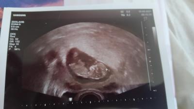 Těhotenství | Miminka únor / březen 2022