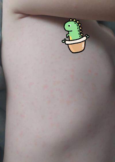 Dětské nemoci | Copak se to dítěti udělalo?