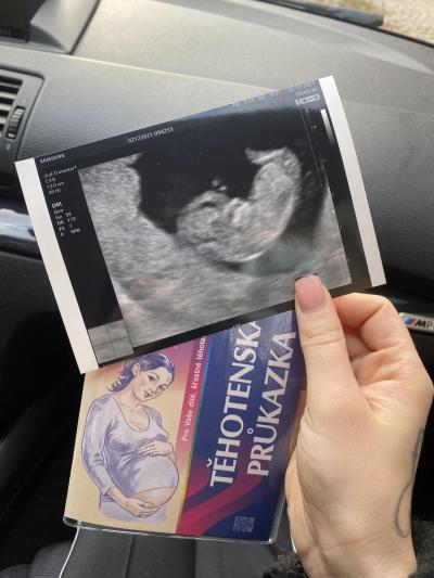 Těhotenství | ♥️ TP - Červen 2022