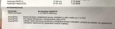 Těhotenství | Dvojčata 2022
