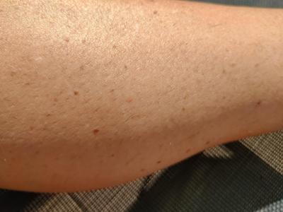 Cvičíme, krásníme a třeba i hubneme | IPL epilator, ano či ne?