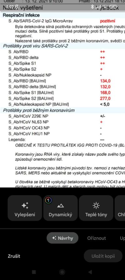 Koronavirus v ČR | Protilátky covid - hodnoty
