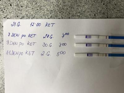 Centra asistované reprodukce | 1. IVF - Repromeda