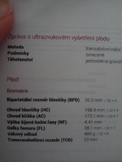 Těhotenství | TP prosinec 2021