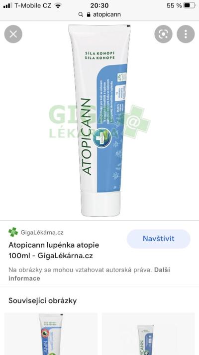 Alergie a ekzémy | Atopický ekzém - svědění obličeje