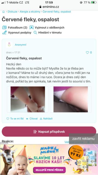 Alergie a ekzémy | Je to jen štípnutí?