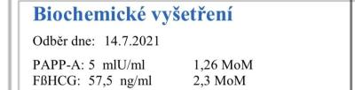 Těhotenství | Dvojčata 2022