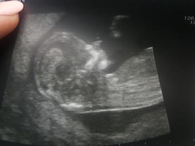 Těhotenství | Miminka únor / březen 2022
