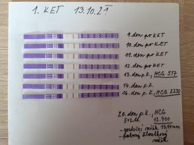 Centra asistované reprodukce | 1. IVF - Repromeda