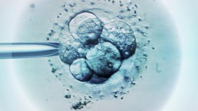 IVF - umělé oplodnění vajíčka. Asistovaný hatching.