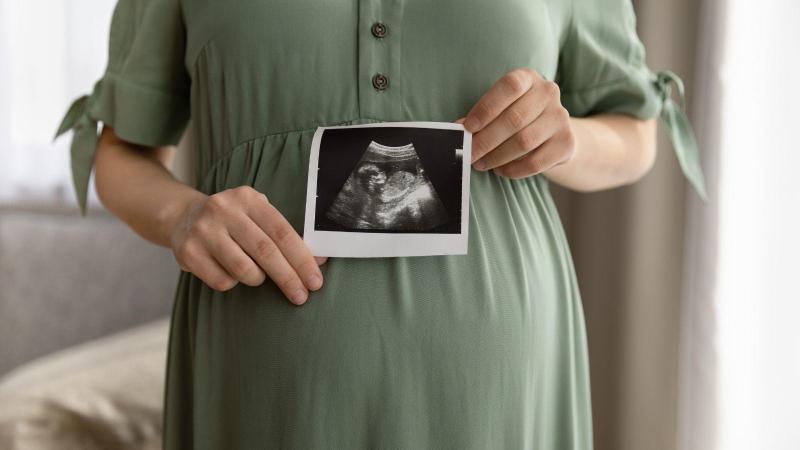 Žena drží fotku ultrazvuku před těhotenským bříškem, screening v druhém trimestru.