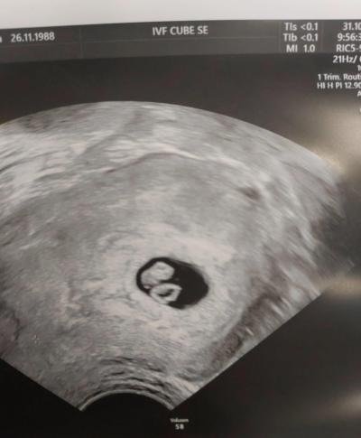 Snažení | IVF cube studie pro rok 2018