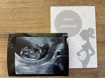 Centra asistované reprodukce | IVF Zlín