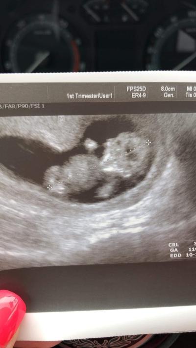 Centra asistované reprodukce | IVF Zlín