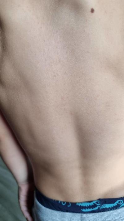 Dětské nemoci | Vyrážka nebo neštovice?