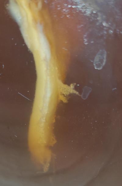 Alternativní léčení | Kombucha