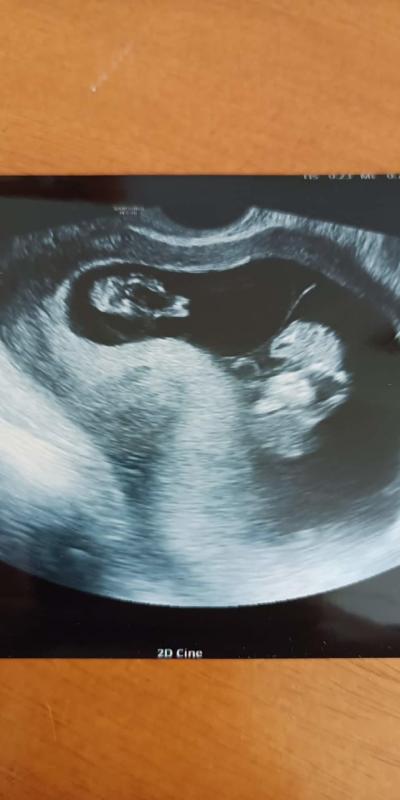 Těhotenství | TP prosinec 2022