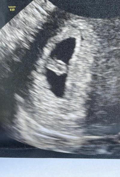 Centra asistované reprodukce | Ivf listopad/prosinec