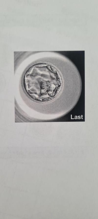 Centra asistované reprodukce | IVF 2022/2023