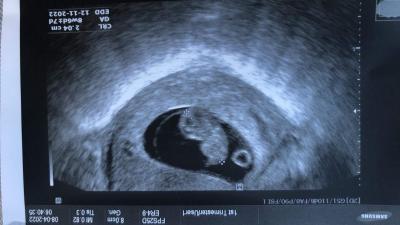 Centra asistované reprodukce | IVF Zlín