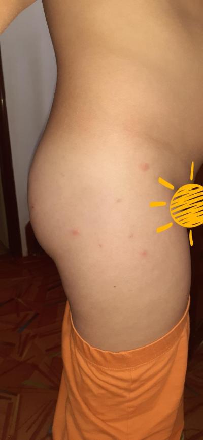 Pozor na prarodiče a příbuzné | Tchyně blechy prázdniny
