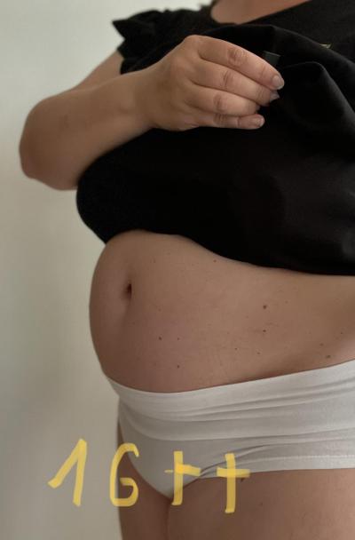 Centra asistované reprodukce | IVF Zlín