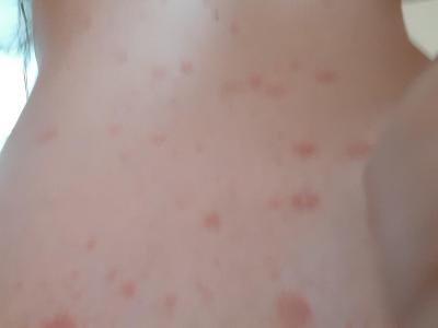 Vše možné | Pytrasia Rosea Gibert