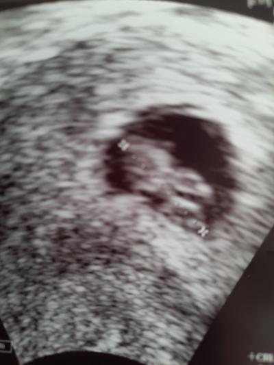 Centra asistované reprodukce | Ivf listopad/prosinec