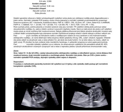 Těhotenství | Ultrazvuk v 16tt. 18tt silný výtok