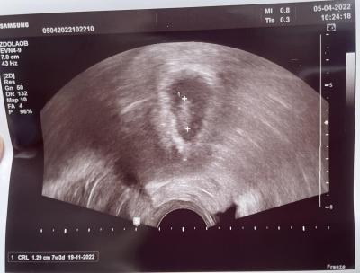 Centra asistované reprodukce | IVF Zlín