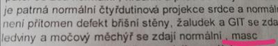 Těhotenství | Co znamená masc?