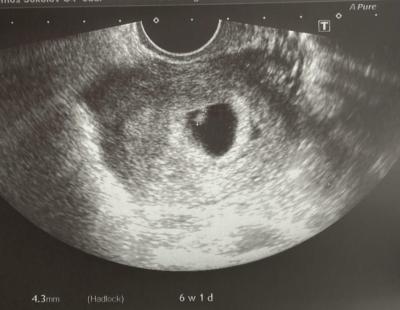 Centra asistované reprodukce | Ivf listopad/prosinec