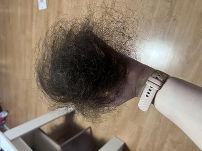 Zdravotní potíže dospělých | Padání vlasů,co s tím?