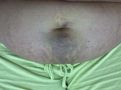 Centra asistované reprodukce | IVF 2022 - ZAŘÍ
