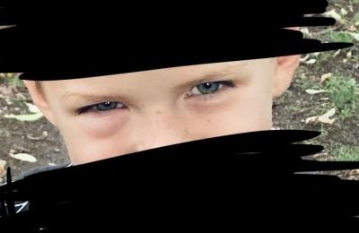 Dětské nemoci | Oteklé jedno oko