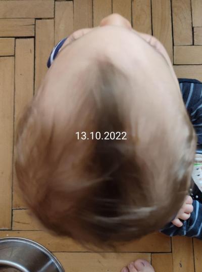 Těhotenství | TP prosinec 2021