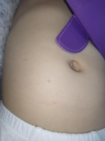 Dětské nemoci | Spala+ neštovice+angina
