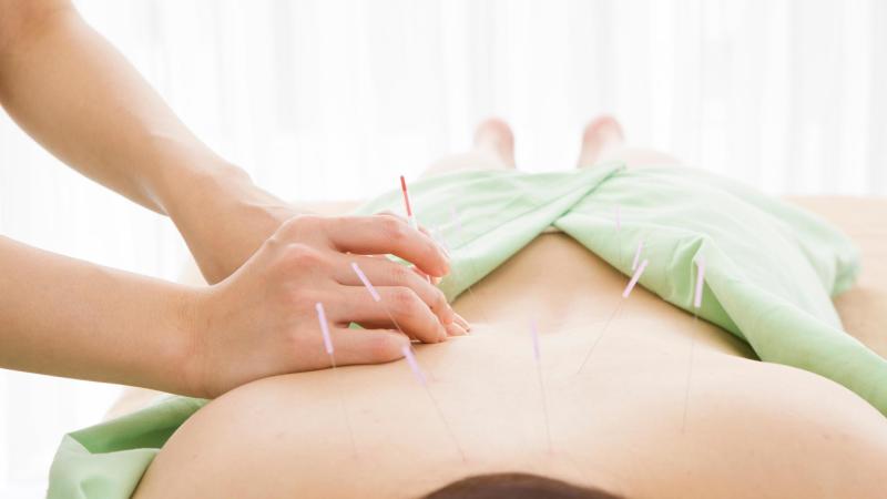 Terapeutka zavádí akupunkturní jehly do zad.