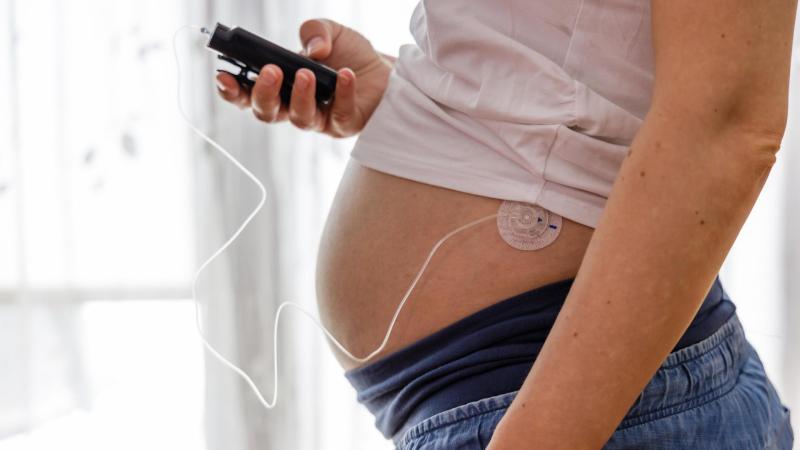 Těhotná žena drží v ruce inzulinovou pumpu. Diabetes v těhotenství, žloutenka.
