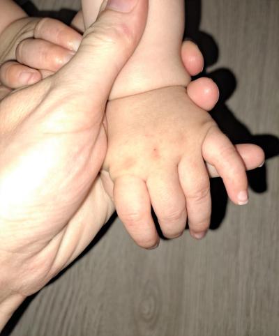 Miminko | Osypané chodidla ,ručičky