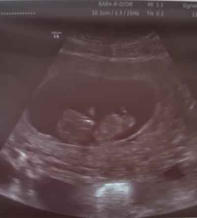 Centra asistované reprodukce | IVF 2023