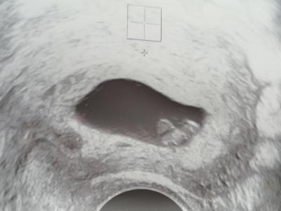 Centra asistované reprodukce | IVF 2023