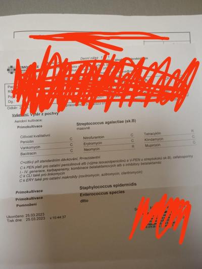 Výrůstky na vulvě a otok