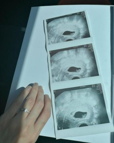 Centra asistované reprodukce | IVF 2023
