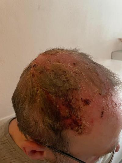 Zdravotní potíže dospělých | Kožní problém pozor foto
