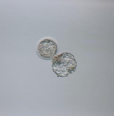 Centra asistované reprodukce | IVF 2022/2023