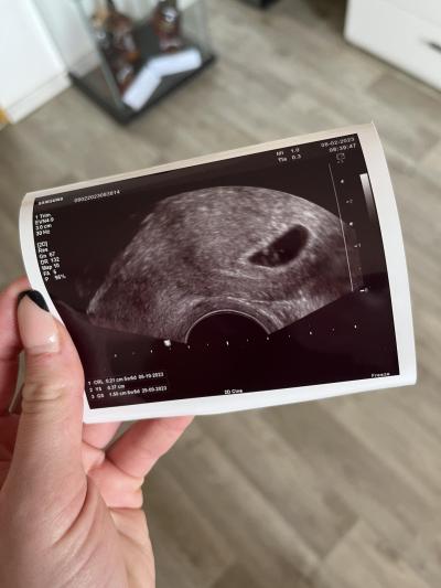 Centra asistované reprodukce | IVF 2023