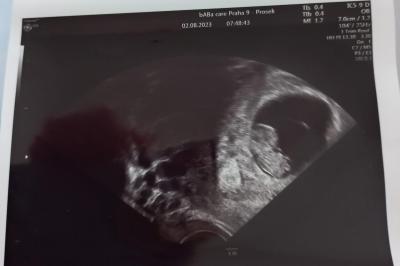 Centra asistované reprodukce | IVF 2023