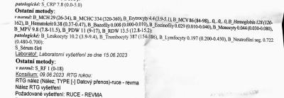 Zdravotní potíže dospělých | Může to být revma?