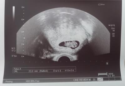 Centra asistované reprodukce | IVF 2023